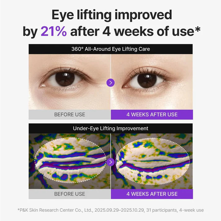 ||75% off|| 360º Shot PDRN lifting Eye cream || 30ml