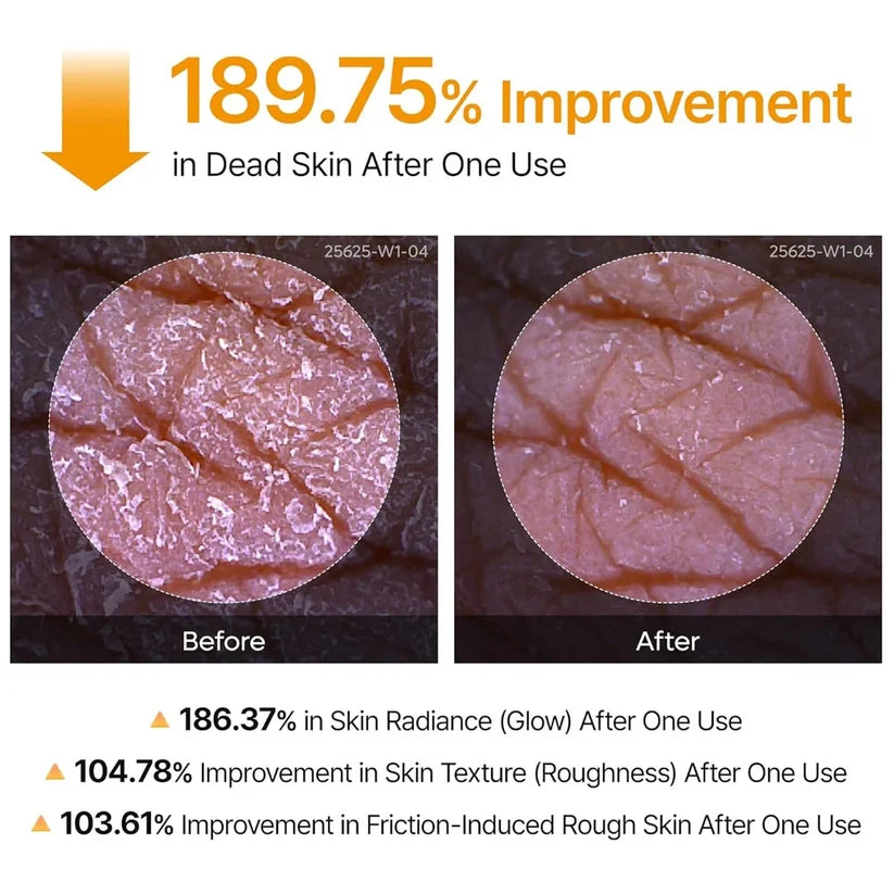 Dr.Melaxin Peel Shot Exfoliating Kojic Acid Turmeric Spray 200ml